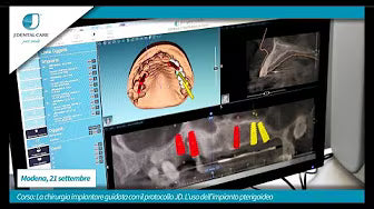 DIGITAL Y CAD CAM